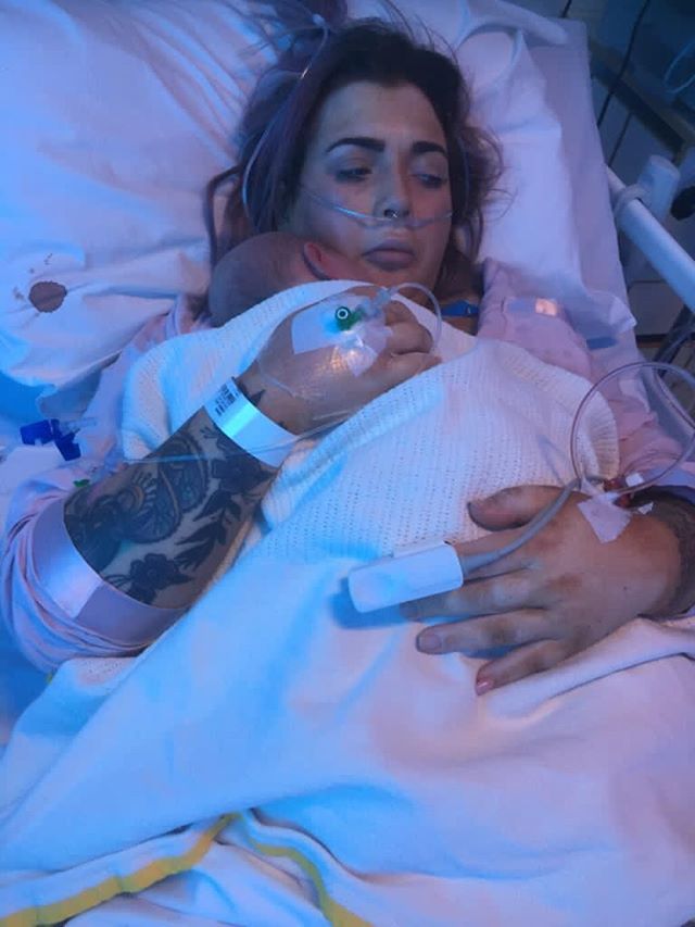 unable to breastfeed after traumatic birth