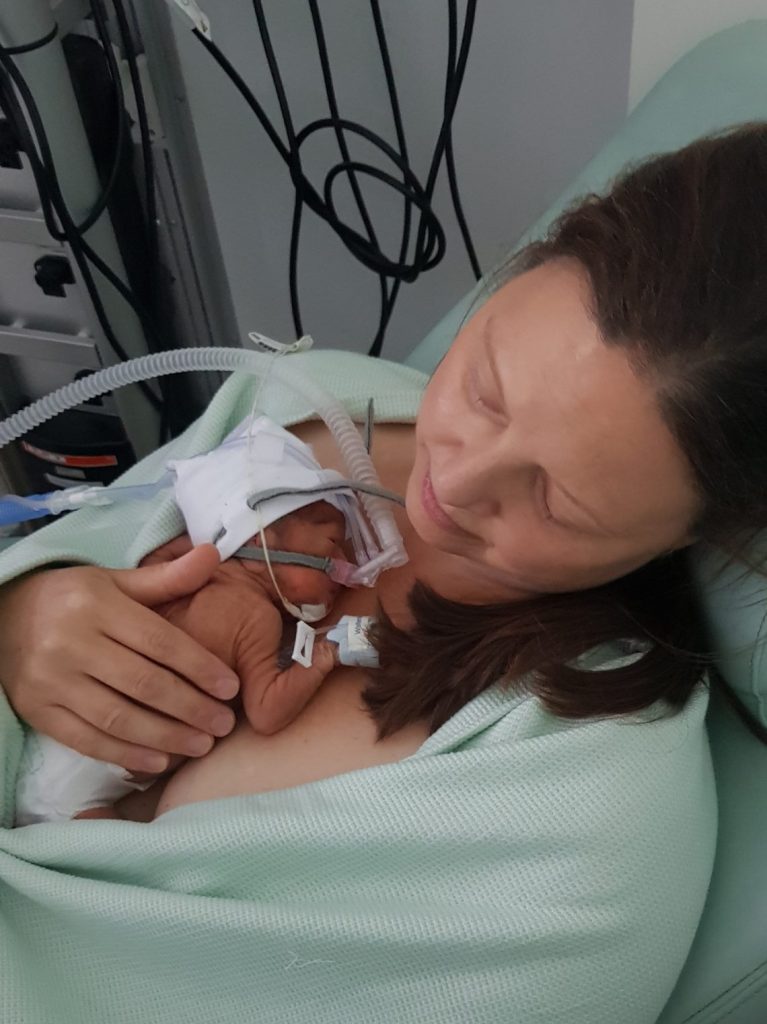 Jo doing kangaroo care with her premature baby