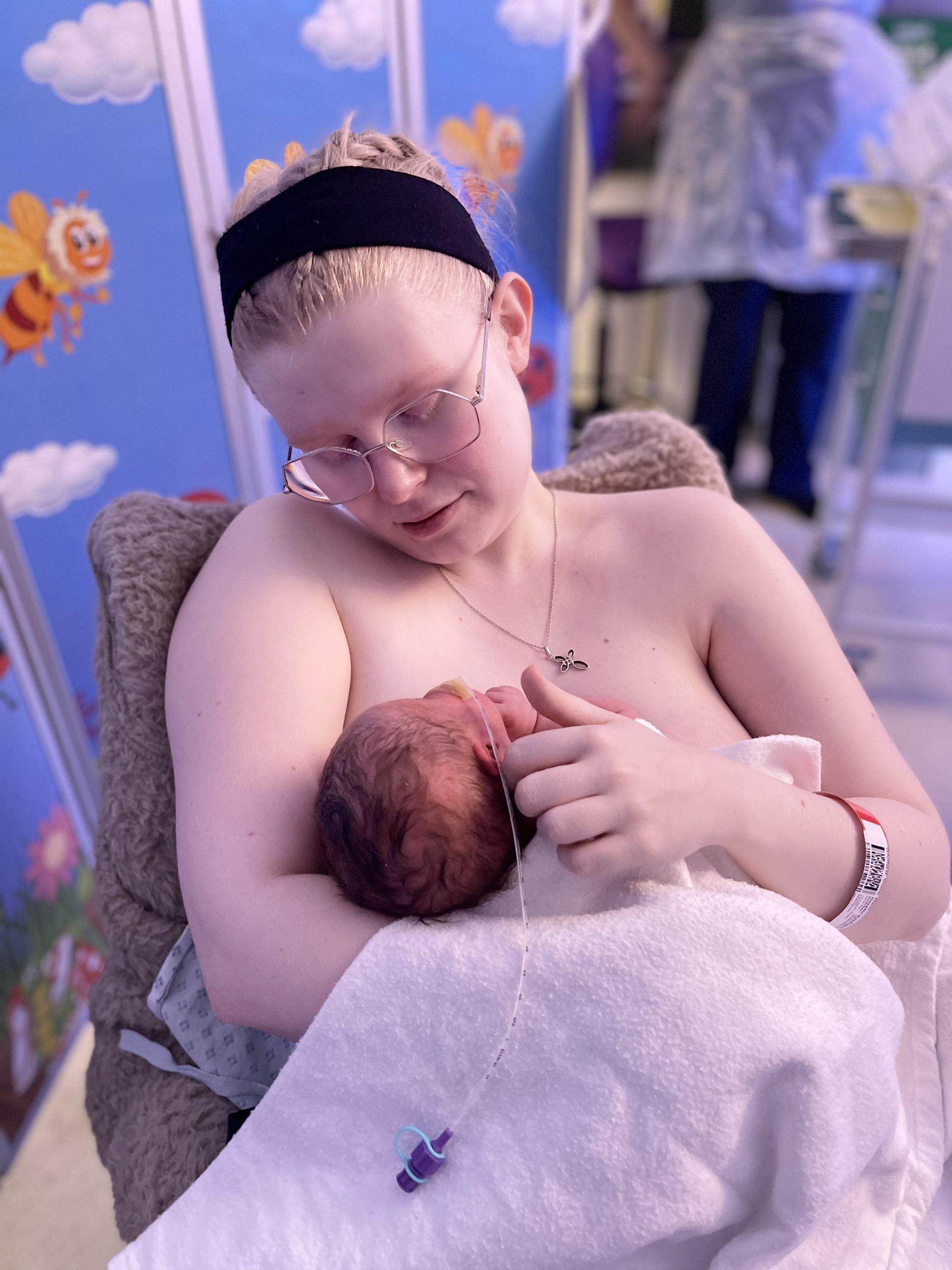 Shellie breastfeeding baby Adonis who has Down syndrome