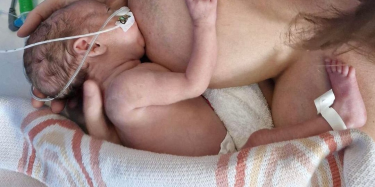 neonatal breastfeeding photo