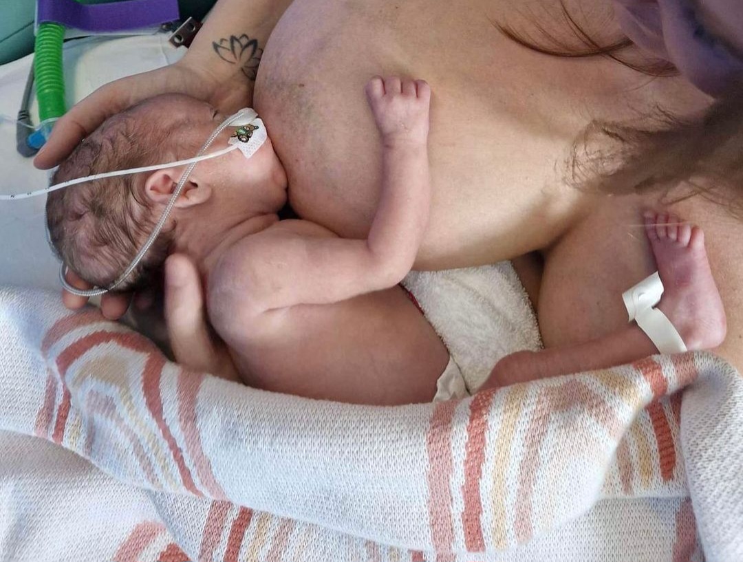 neonatal breastfeeding photo