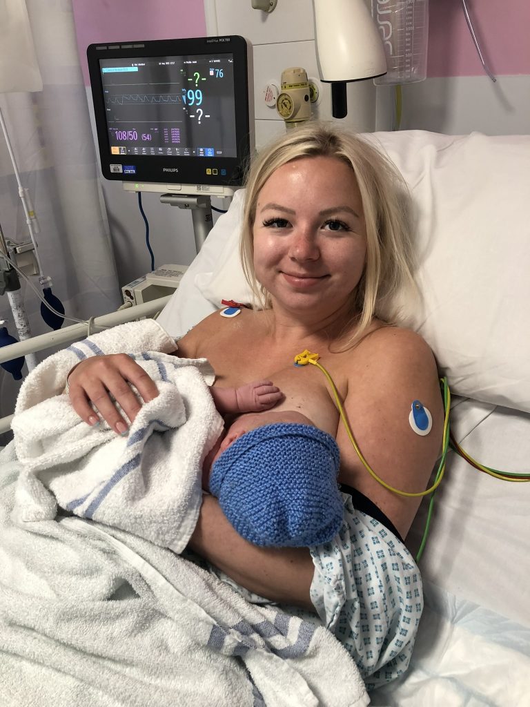 Breastfeeding after a c-section