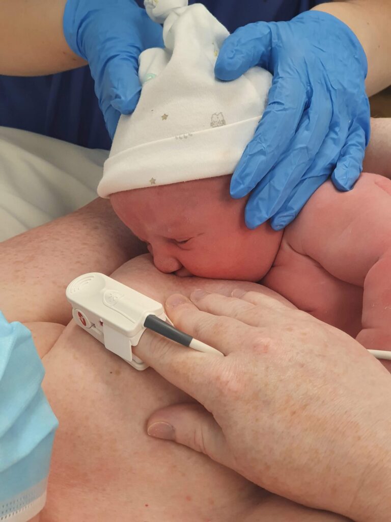 baby learning to breastfeed after caesarean birth