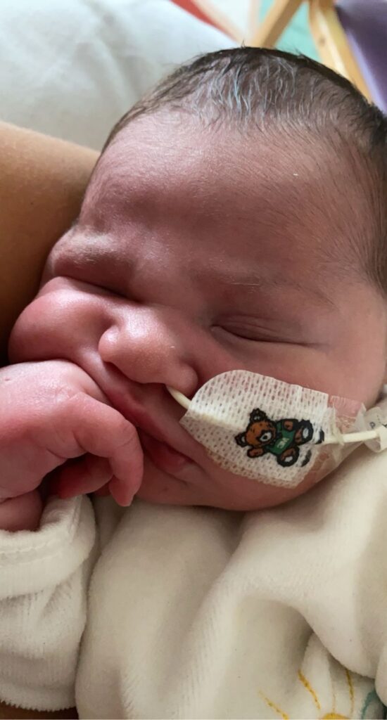 Tamara's newborn son with NG tube